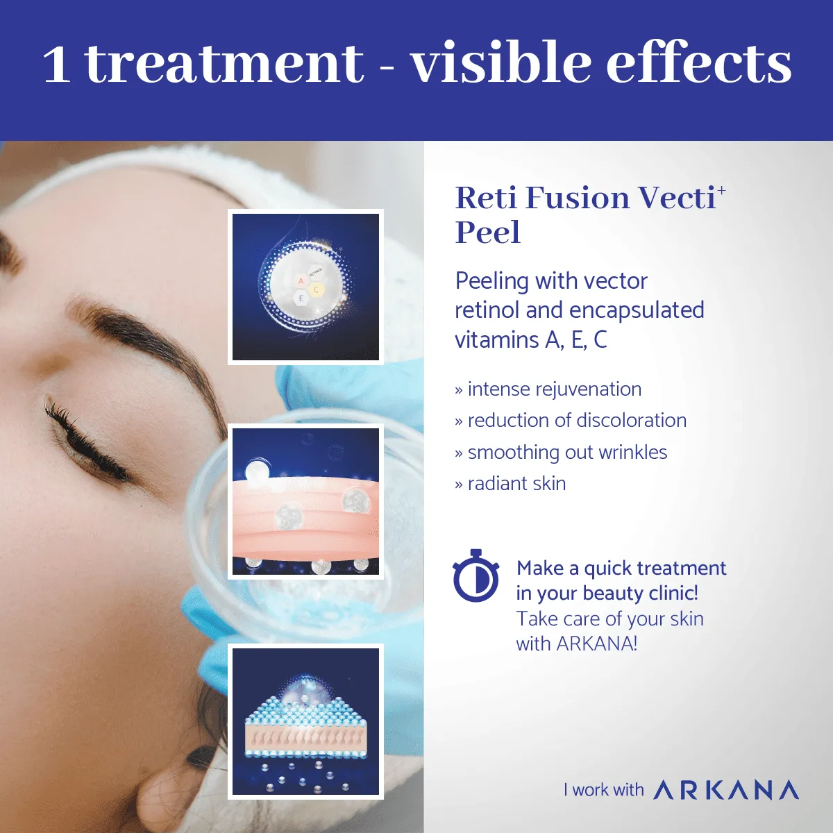 Reti Fusion Vecti+ Essence Mask 50ml